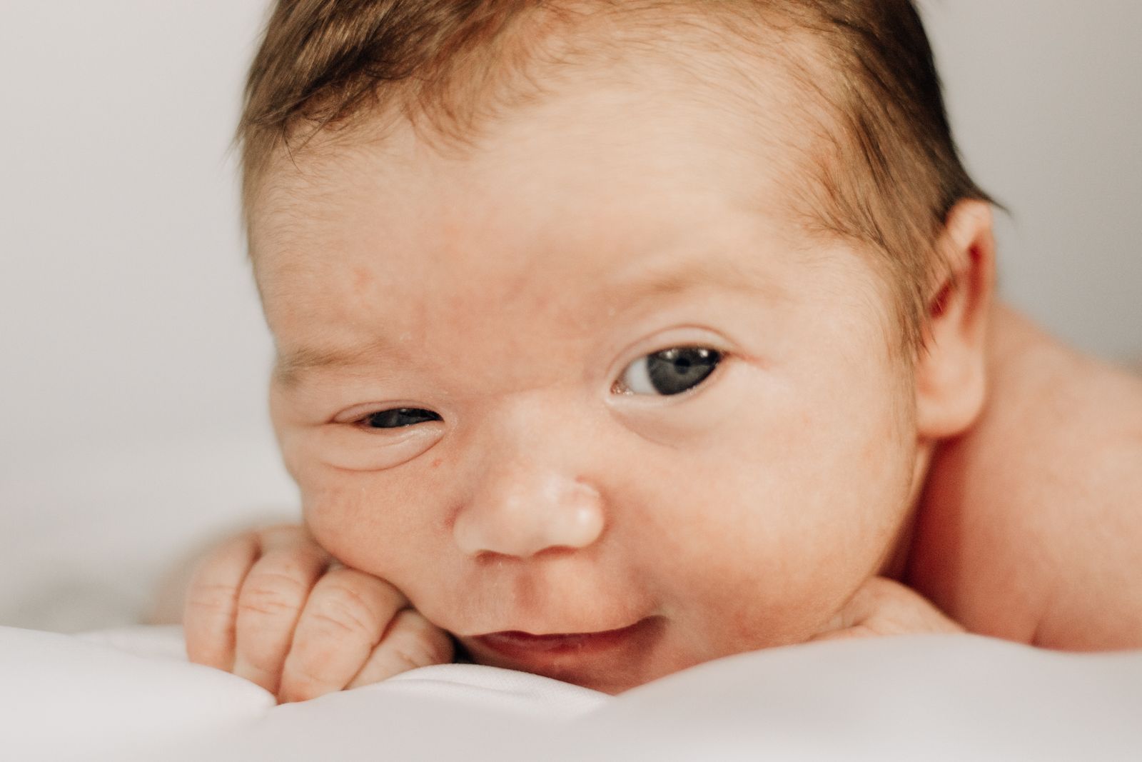 Cradle Cap on Babies: 7 Gentle Ways to Get Rid of It