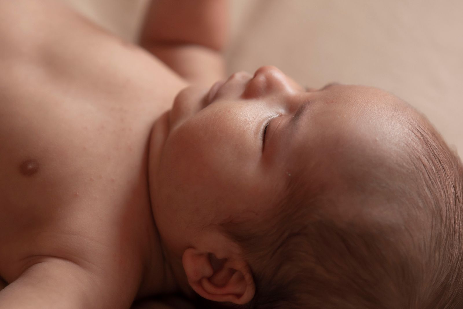 Close-up of a sleeping newborn's head and fine hair, the scalp where cradle cap appears